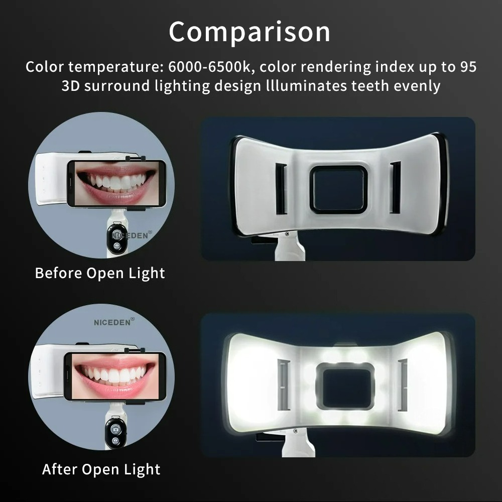 Dental Photography Light Phone - Photography Lighting Accessories 评论和价格